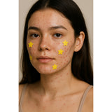 Simplosophy Hydrocolloid Star Pimple Patches - 72 Patches